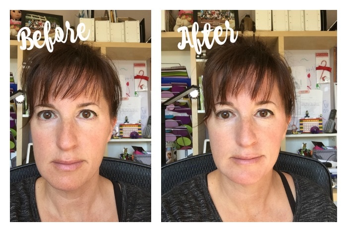 StriVectin Advanced Retinol Pore Refiner before and after