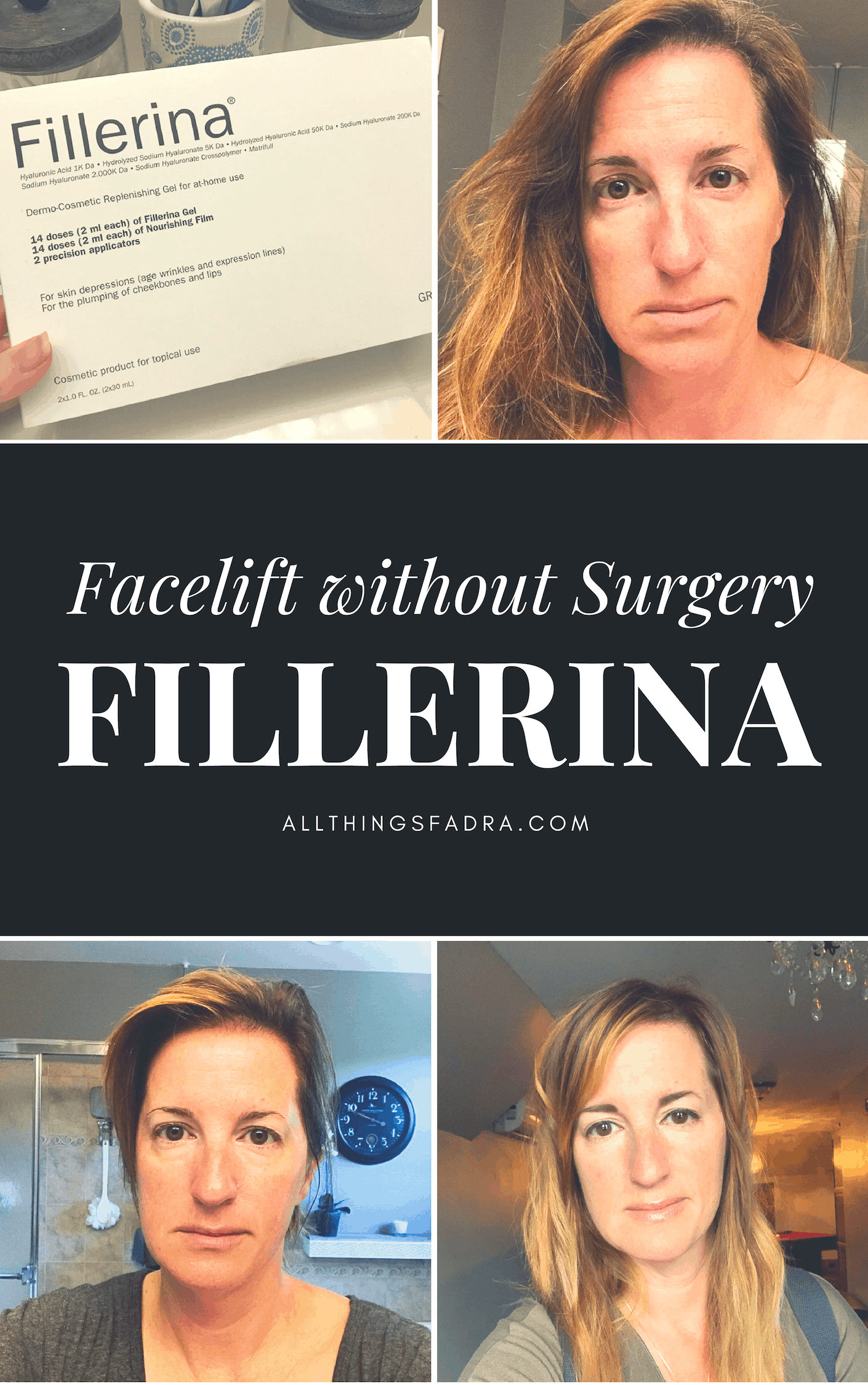 I TRIED IT! Is Fillerina A Facelift Without Surgery? • All