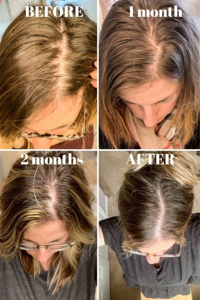 Vegamour before and after results