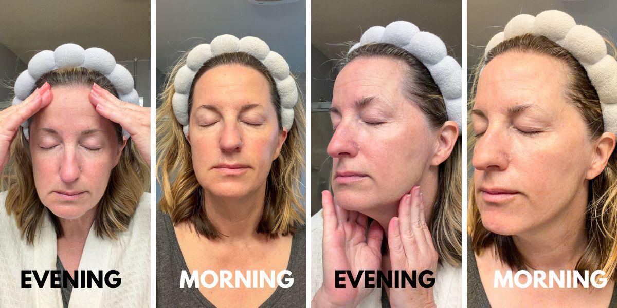 Besque Review: Is Oil-Based Skincare Better for Dry, Mature Skin?